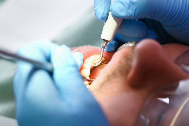 Best Pediatric Emergency Dentist in Carrollton, KY